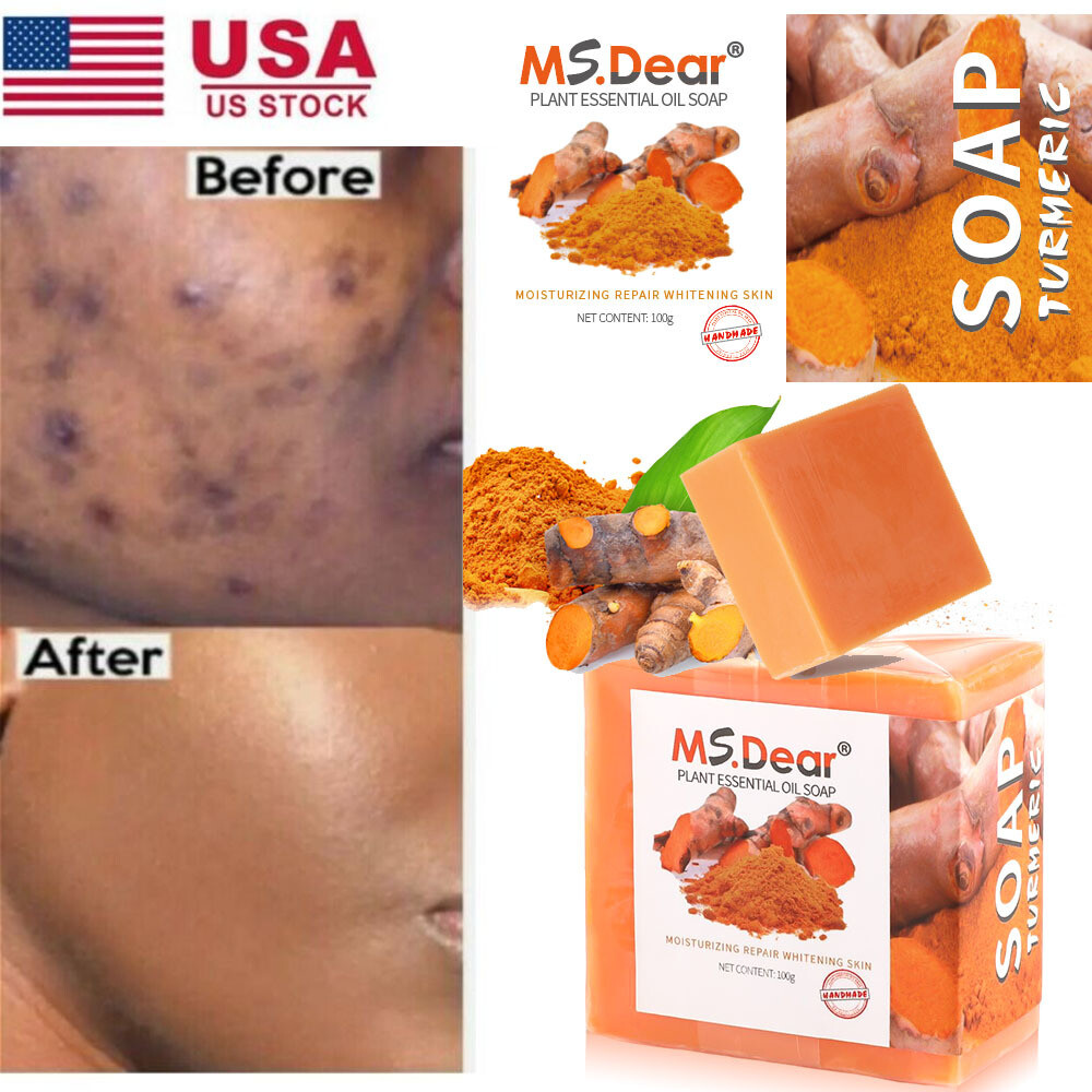 5x Turmeric Soap Face Cleansing Anti Acne Skin Brighten Remove Pimples Dark Spot
