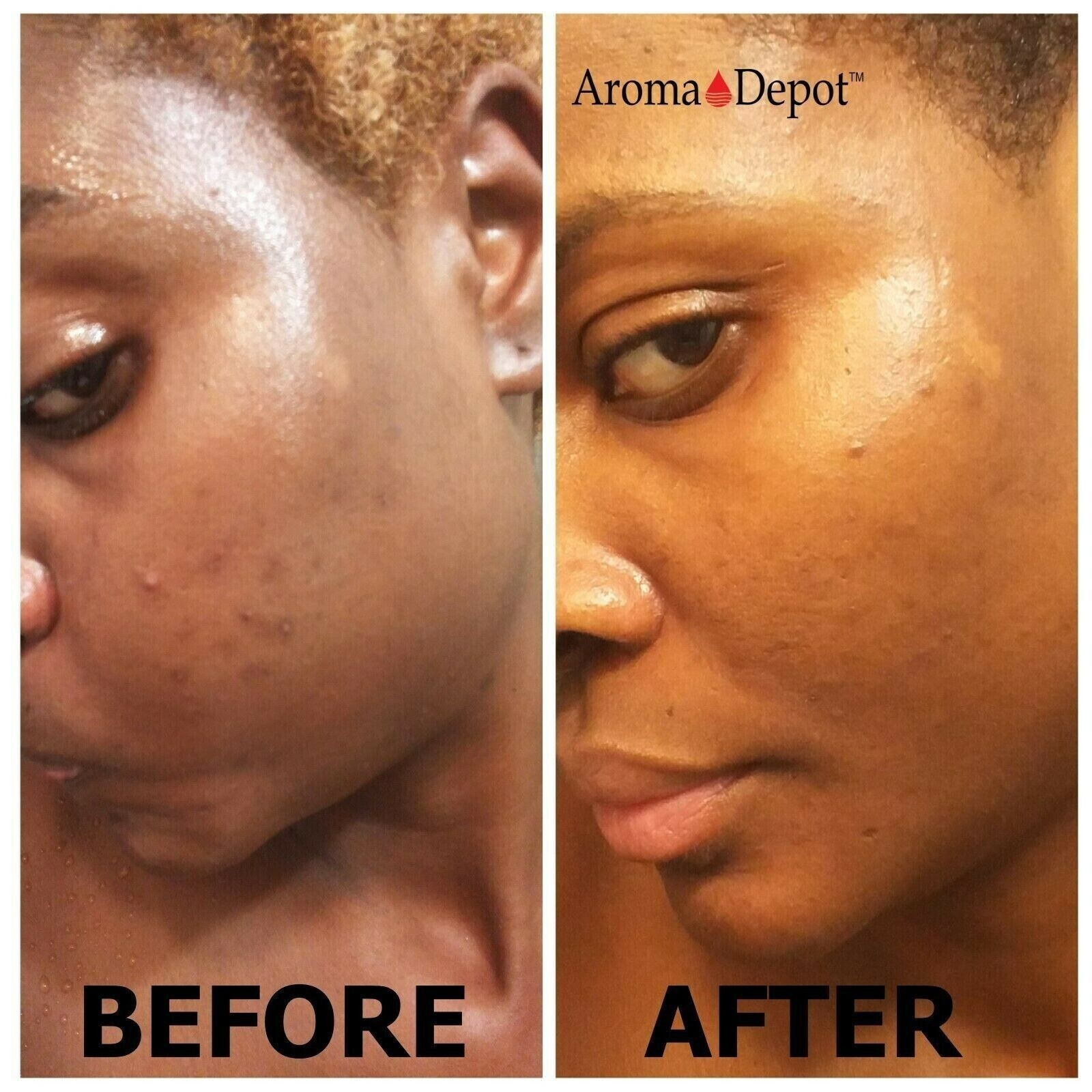 Raw African Black Soap Wholesale 100% Pure Organic Unrefined Natural Soap Bar
