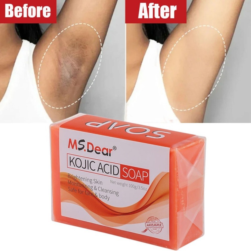 1Pcs Kojic Acid Soap Dark Spot Whitening Turmeric Skin Bleaching Lightening 100g