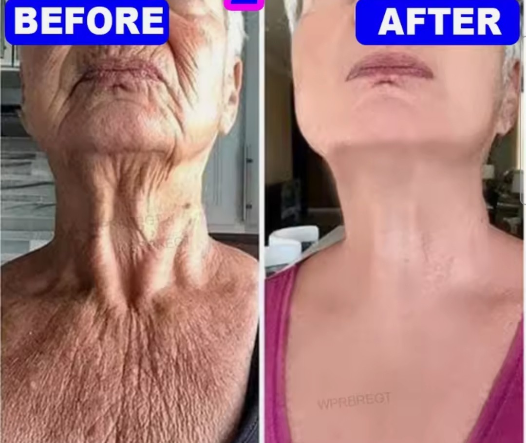 3-pk Niacinamide Brightening Soap Anti-Dark Spot Cleanser, 110g [USA Stock]