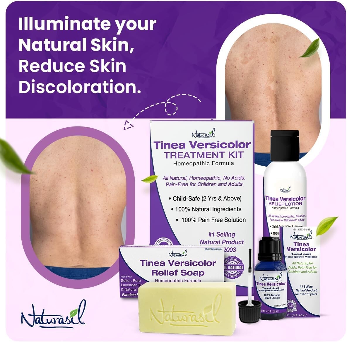 Naturasil Tinea Versicolor Treatment +2 Bars | Max-Strength 10X Soap | Antifunga