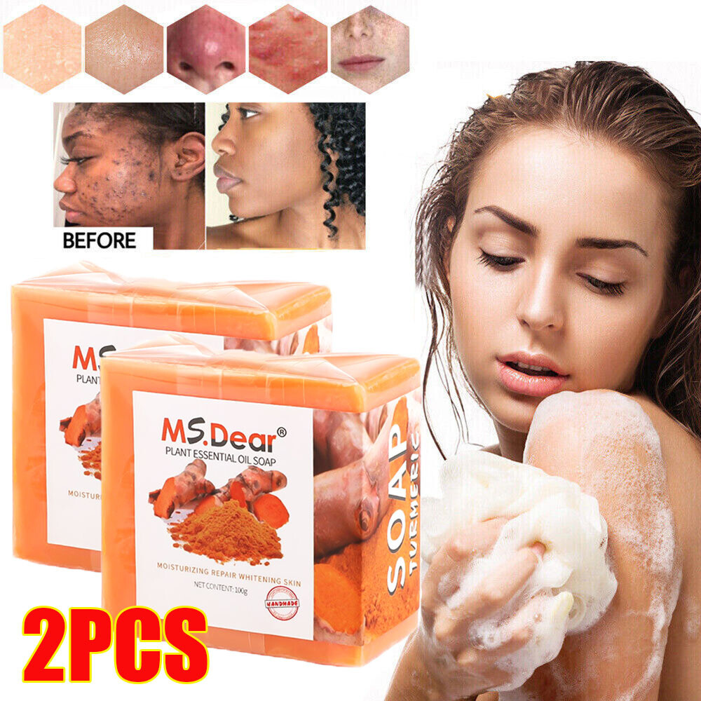 2x Tumeric Soap Acne Dark Spot Removal Skin Whitening Facial Body Bleaching Soap