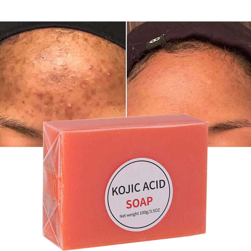 1Pcs Kojic Acid Soap Whitening Soap Brightening Remove Black Spots Brighten 100g