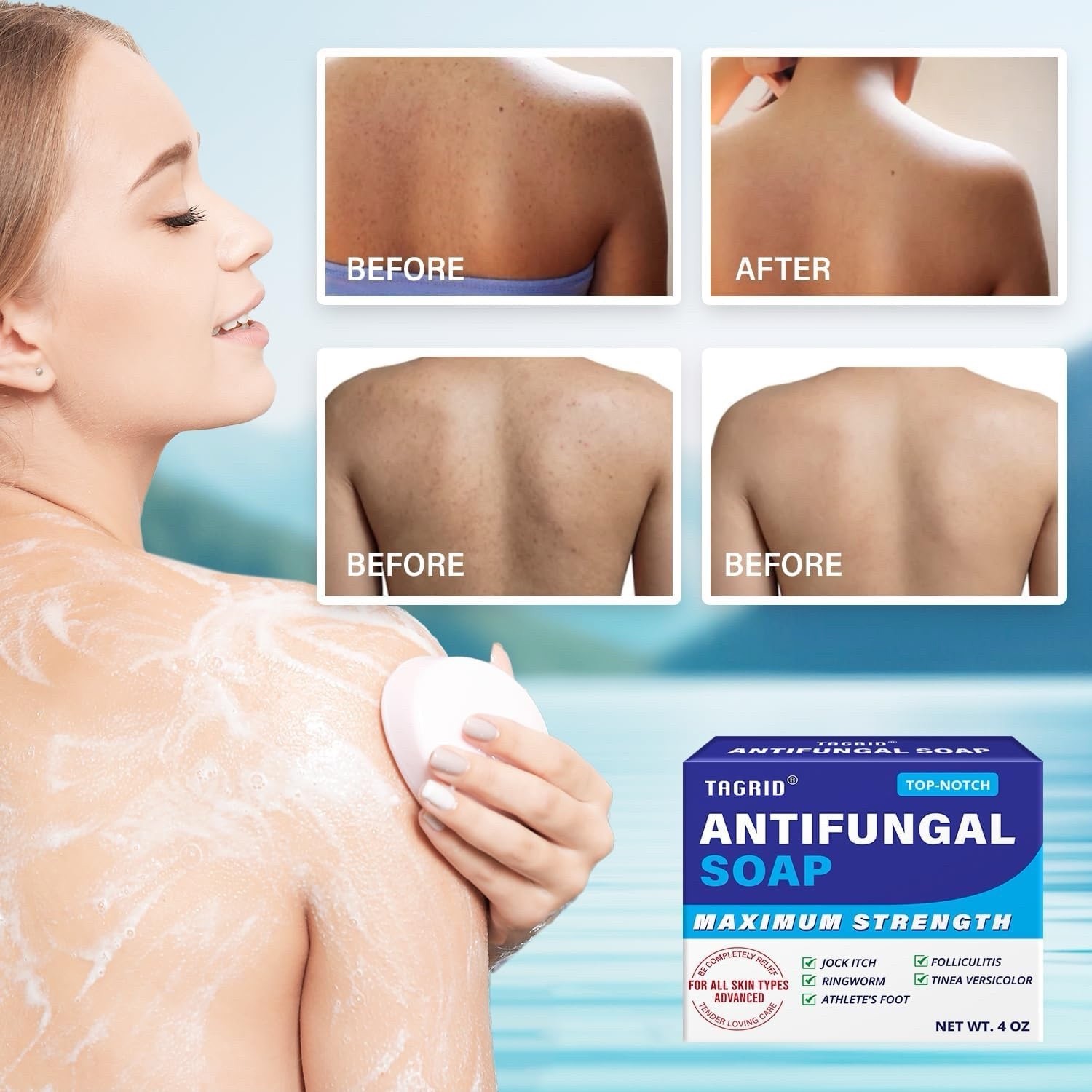 4 oz Antifungal Soap with Tea Tree Oil Antifungal Bar Soothing Care Itch Relief