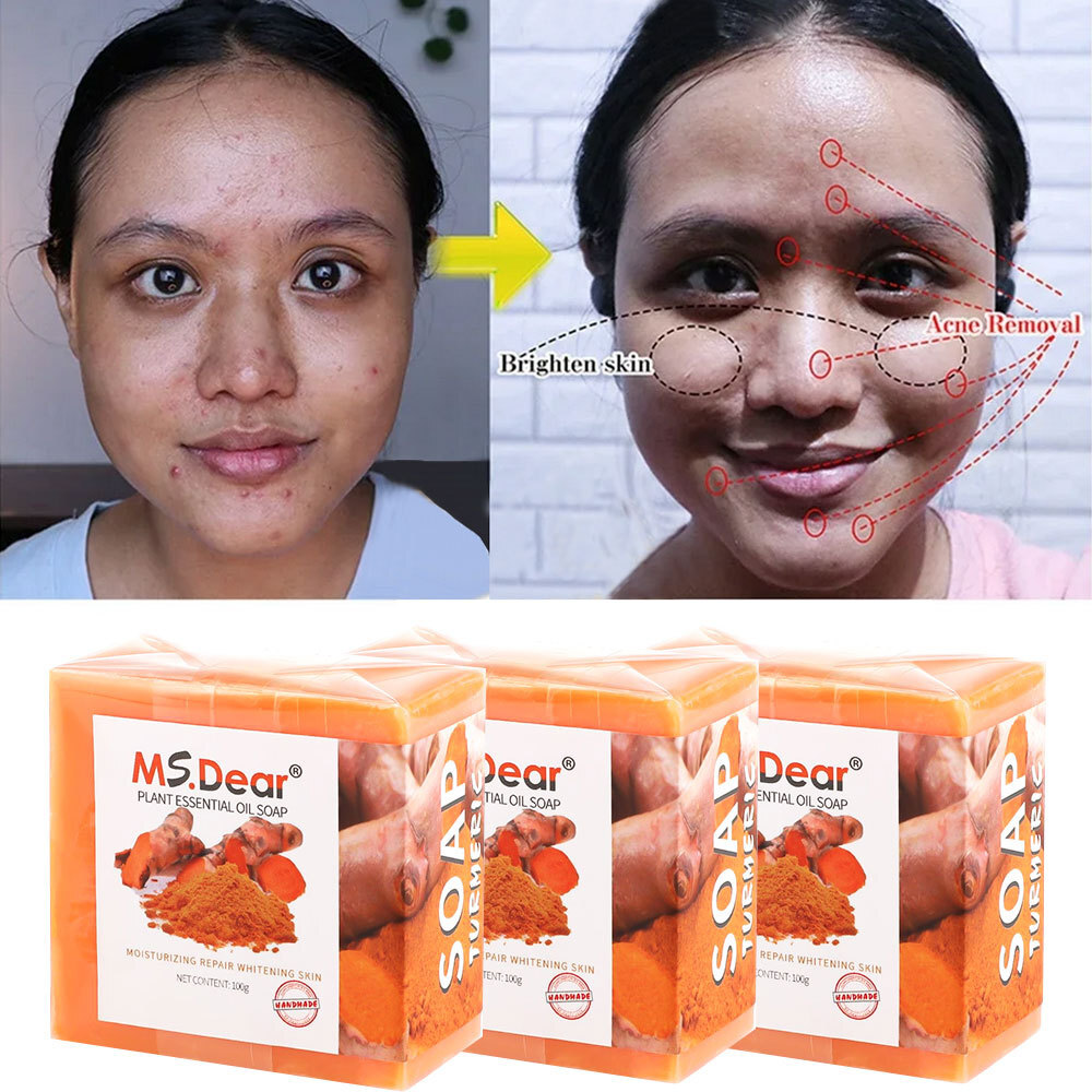 4X Turmeric Soap Bar for Face & Body-Tumeric Soap,Acne, Dark Spots, Smooth Skin
