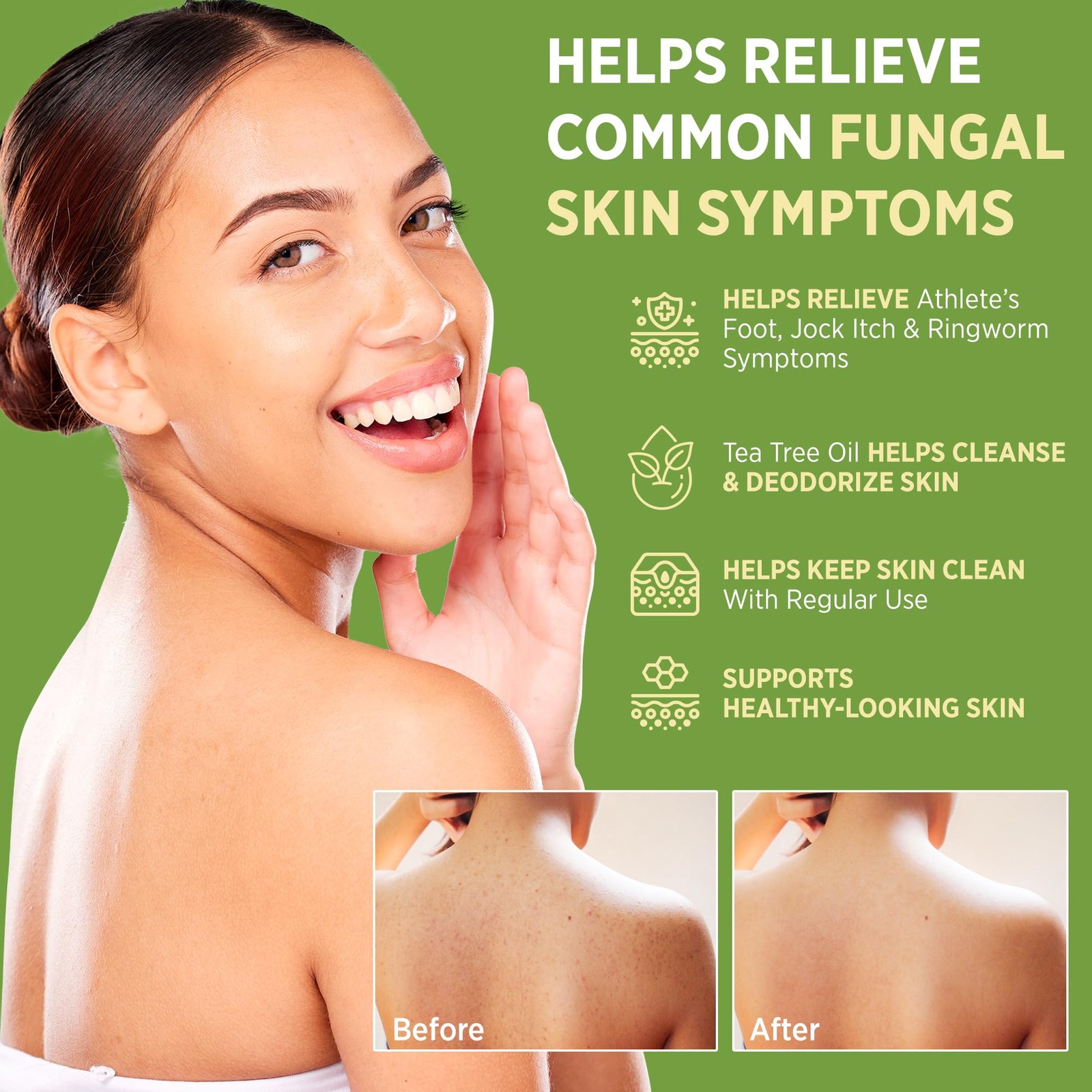 Roycederm Antifungal Bar Soap Tea tree Oil Soap Athlete’s Foot Treatment for