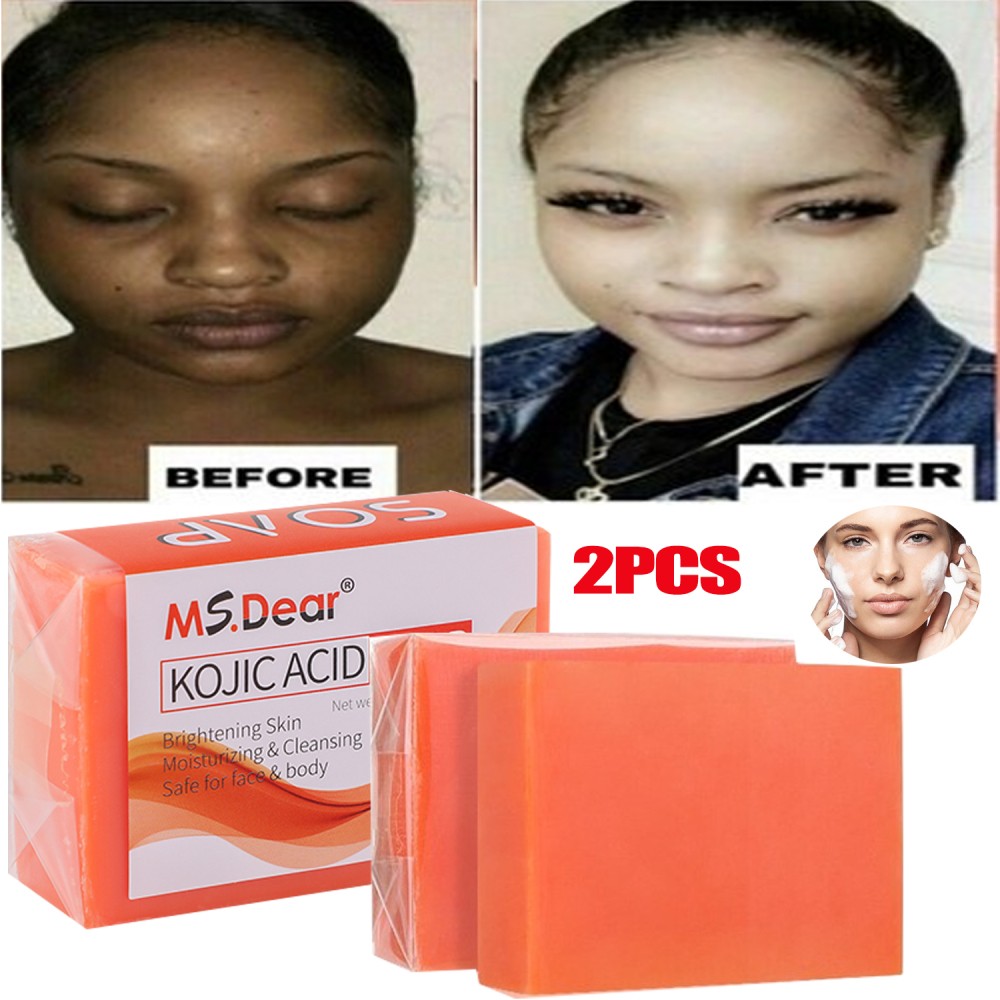 2X Kojic Acid Soap Dark Spot Whitening Turmeric Soap Skin Bleaching Lightening