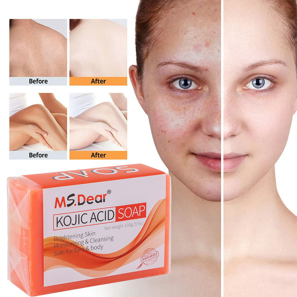 Original Kojic Acid Soap for Dark Spots Whitening, Turmeric Soap Skin Lightening