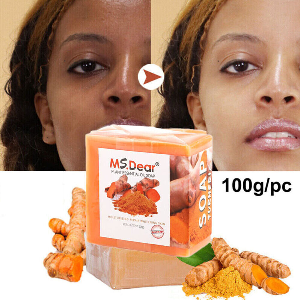 5x Turmeric Soap Face Cleansing Anti Acne Skin Brighten Remove Pimples Dark Spot
