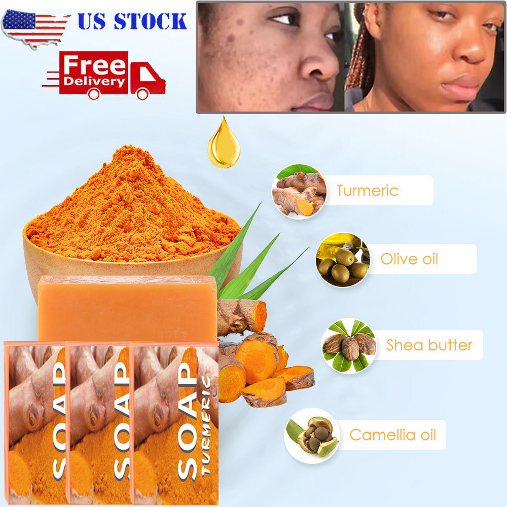 3pc Tumeric Soap Skin Whitening Dark Spots lightening Acne Brightening Turmeric