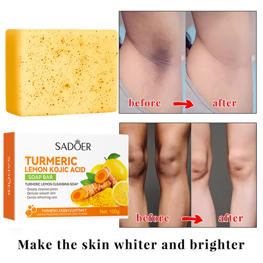 Lemon Turmeric Kojic Acid Soap Bar, Turmeric Face and Body Soap, Deep Clean 100g