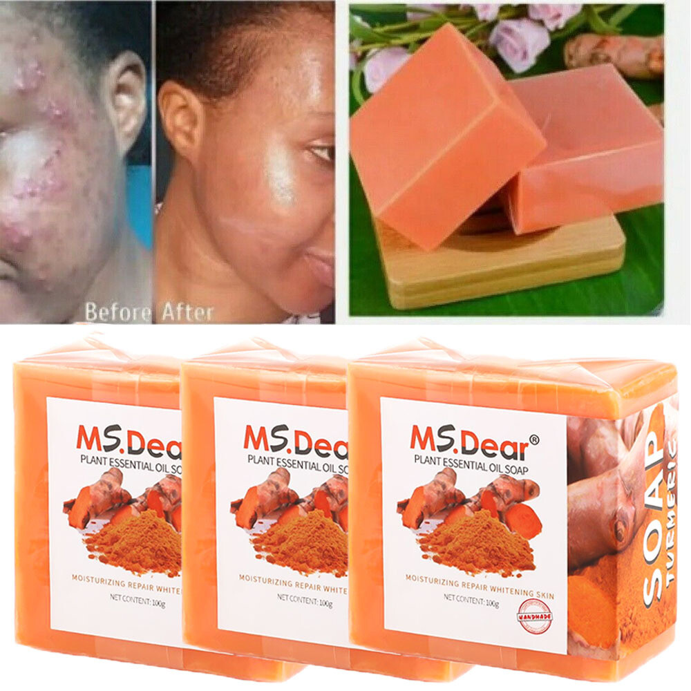 3/1x Tumeric Soap Skin Whitening Dark Spots lightening Acne Brightening Turmeric