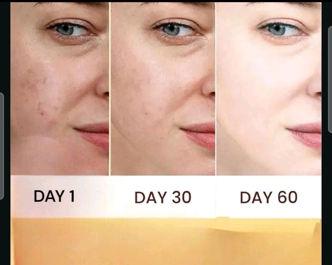4-Pk Kojic Arbutin Brightening Bar Soap Skin Dark Spot Remover 160g [USA Stock]