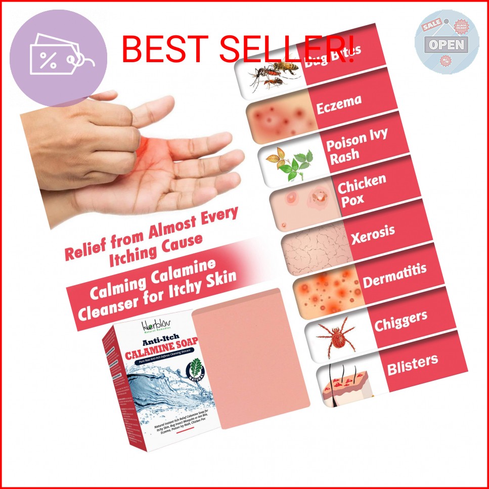 Natural Instant Itch Relief Soap Bar – Calming Calamine Soap for Itchy Skin, Bug