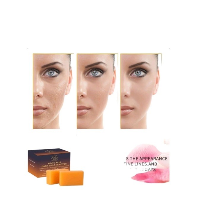 Kojic Acid Dark Spot Remover Soap Bars with Vitamin C Retinol, Collagen Turmeric