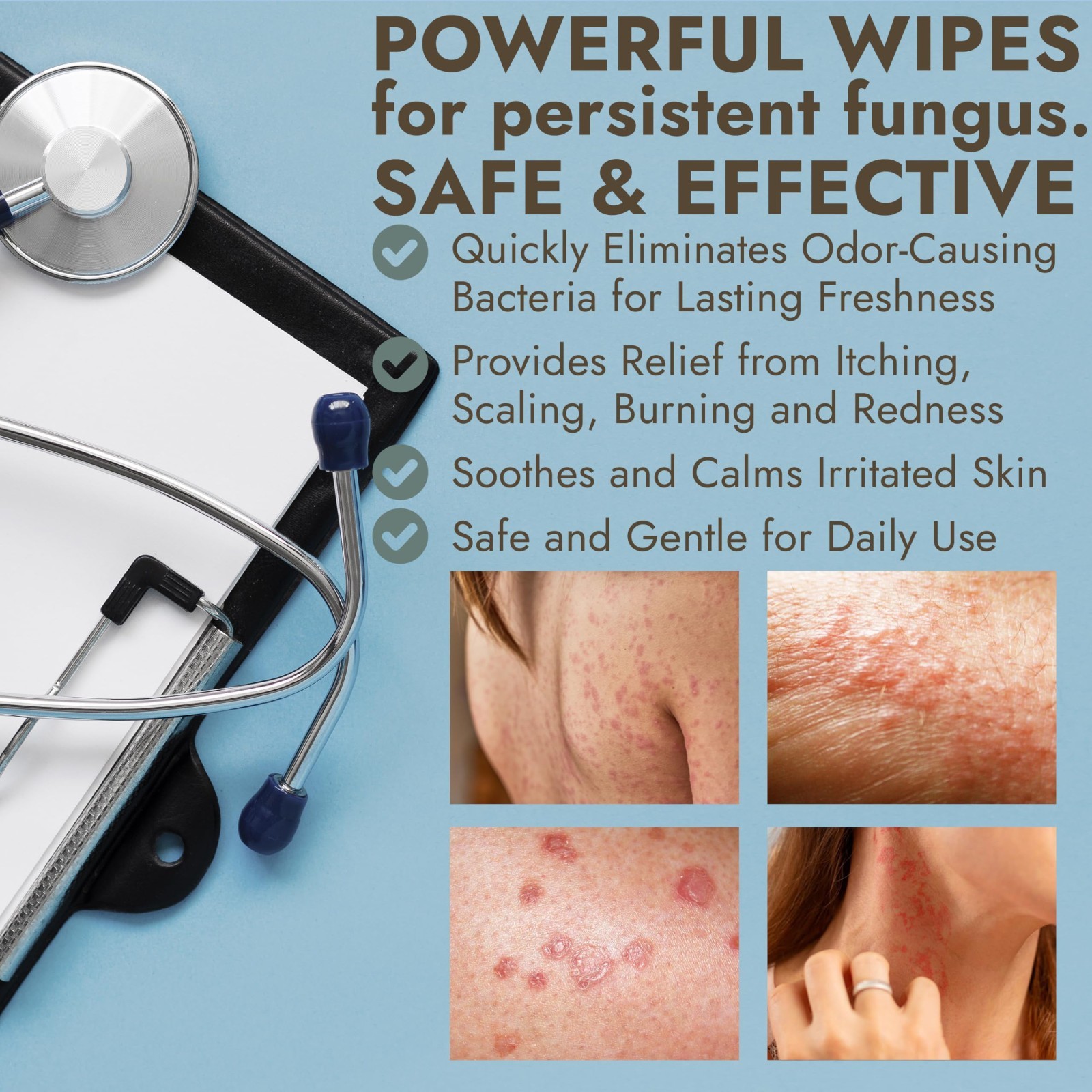 Antifungal Soap Pack with Case & Body Wipes | 1% Tolnaftate, Tea Tree Oil | Figh
