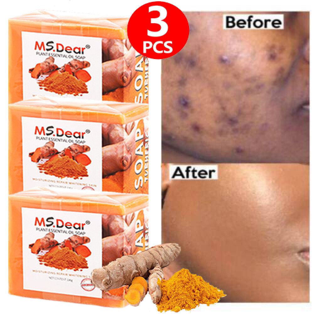 3PCS Tumeric Soap Skin Whitening Dark Spots lightening Acne Brightening Turmeric