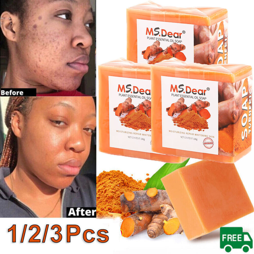 5/1x Tumeric Soap Skin Whitening Dark Spots lightening Acne Brightening Turmeric