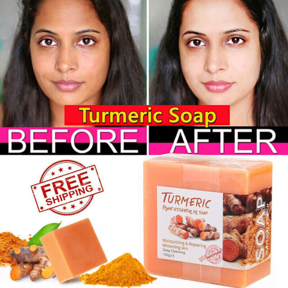 20X Tumeric Soap Skin Whitening Dark Spots lightening Acne Brightening Turmeric