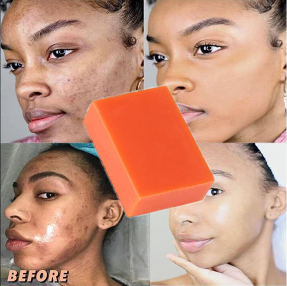 Kojic Acid Skin Whitening Soap Acne Lightening Bar 100g Facial Body Care Soap