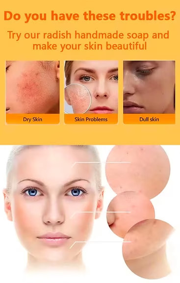 MM Skincare Glam Carrot Soap Deep Cleansing Brightening Bar for All Skin – 100g