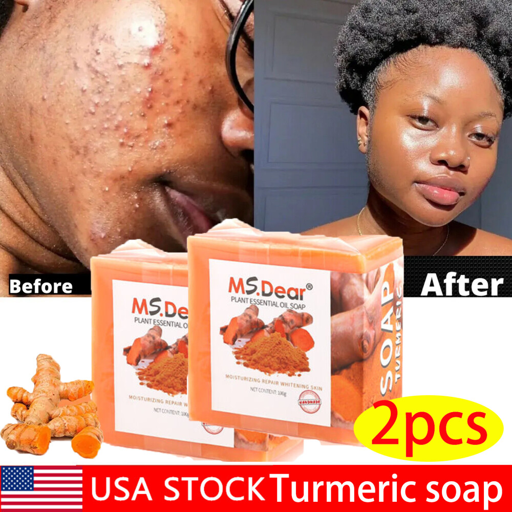 2× Tumeric Soap Skin Whitening Dark Spots lightening Acne Brightening Turmeric