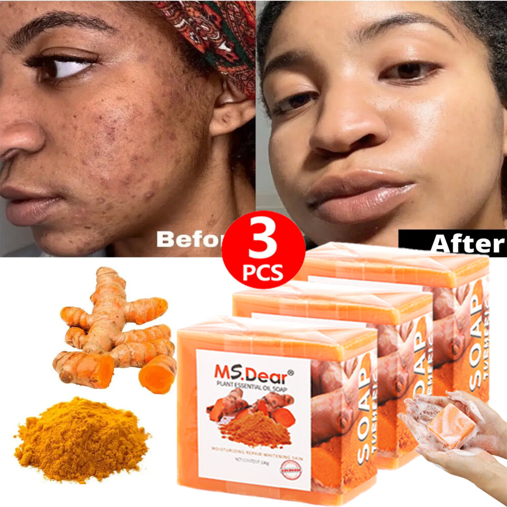 3PCS Tumeric Soap Skin Whitening Dark Spots lightening Acne Brightening Turmeric