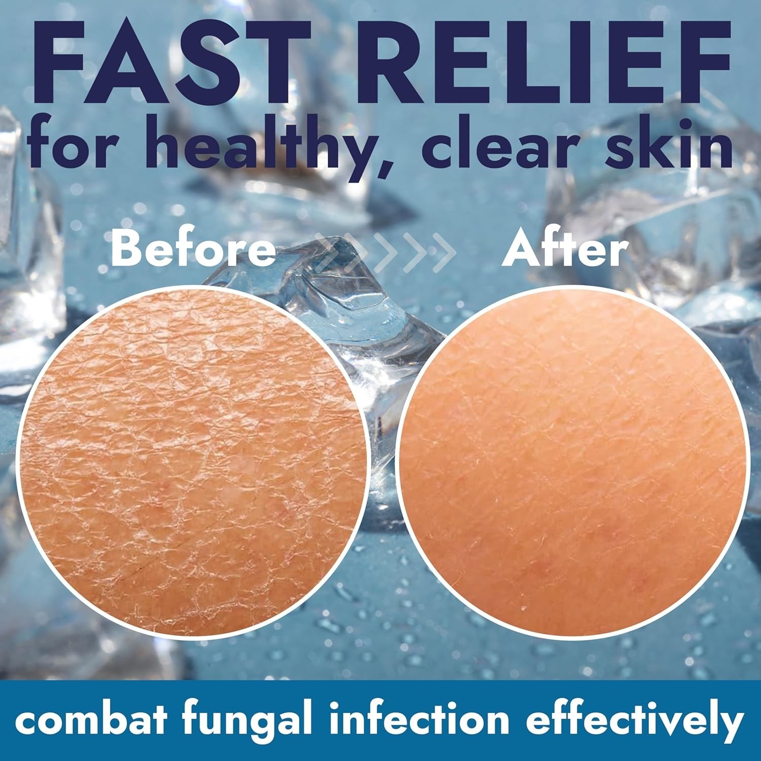 Antifungal Soap Infused with Peppermint Essential Oil | Medicated Tolnaftate 1%