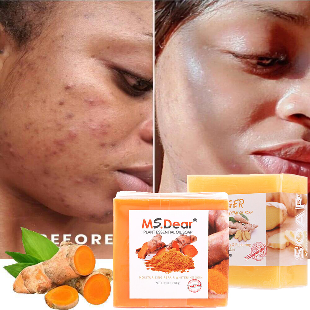 Dark Tumeric Soap Skin Whitening 1-3X Spots lightening Acne Brightening Turmeric
