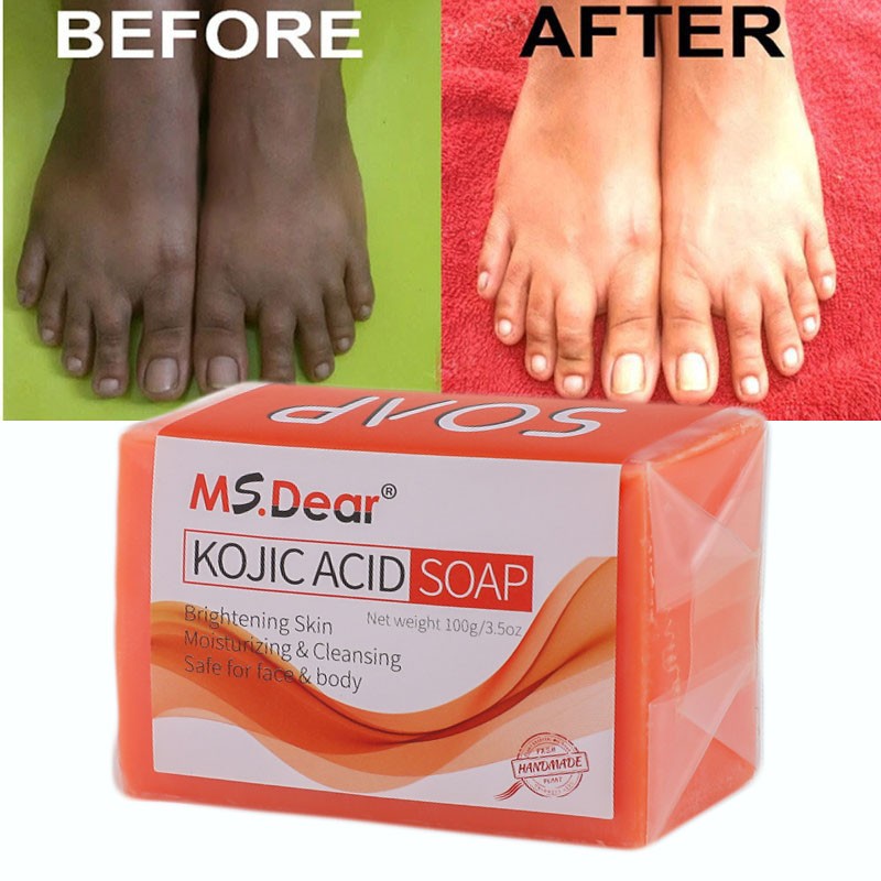 Handmade Kojic Acid Soap Face Body Care Soap Facial Cleansing Moisturizing Soap