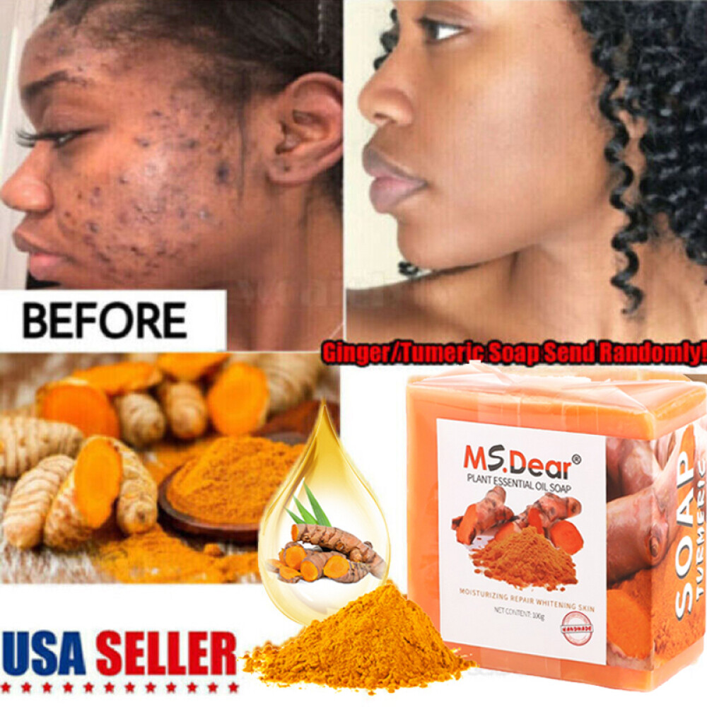 Tumeric Soap Acne Dark Spots Removal Skin Whitening Facial & Body Bleaching Soap
