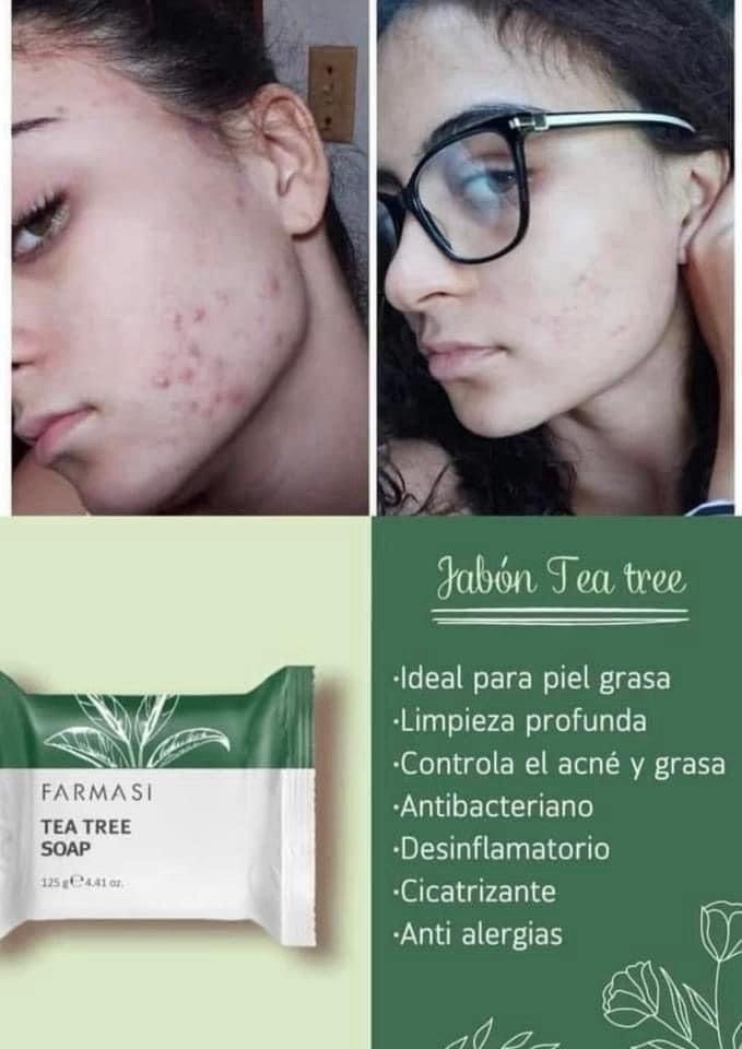 Controls acne and oiliness • Healing • Anti-Acne Bar Soap 125 g White