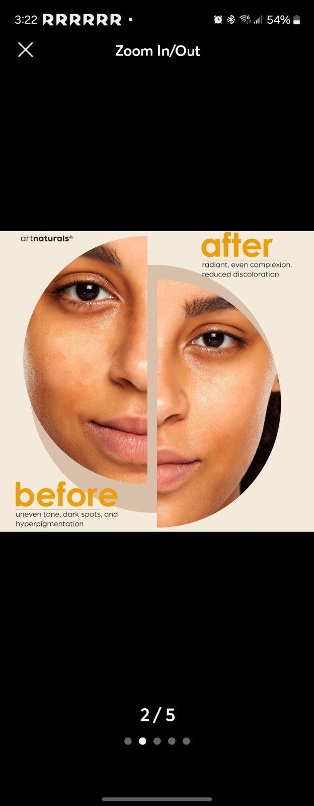 Artnaturals Kojic Acid With African Net