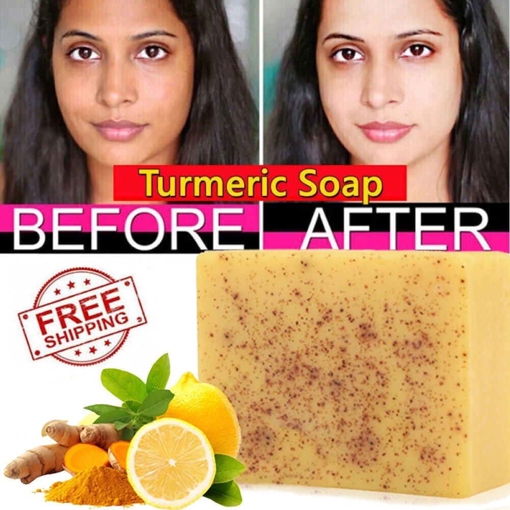 Turmeric & Lemon Handmade Soap with Foaming Net – Skin Lightening Moisturizing