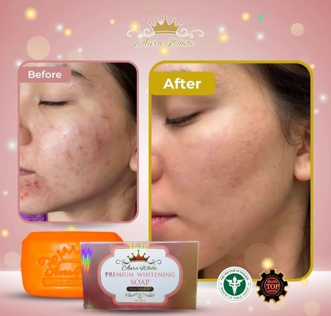 Aura White Premium Whitening Face&Body Soap 120g✨️👌, 1pc
