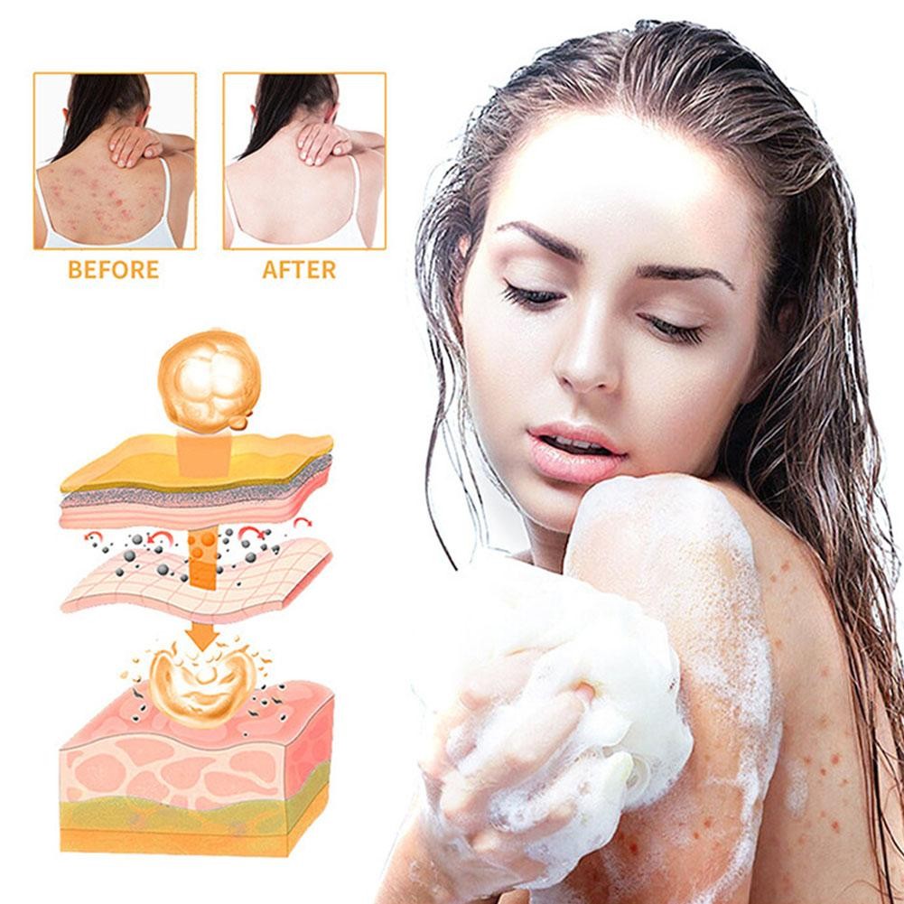 Seoul Secret Soap Lighten SkinTone Fresh MoistureArbutin Dry Skin Moisturi HOT