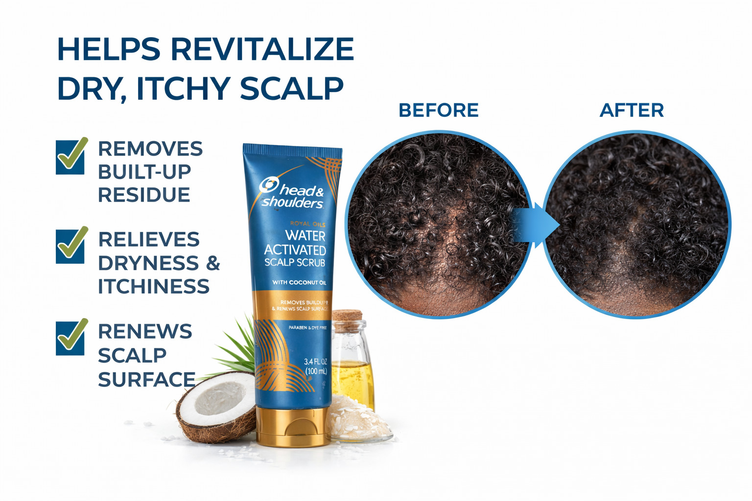Lot of 70 Head & Shoulders Royal Oils Water Activated Scalp Scrub w/Coconut Oil