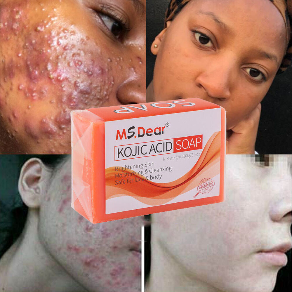Kojic Acid Soap Dark Skin Whitening Bleaching Lightening Brightening Face & Body