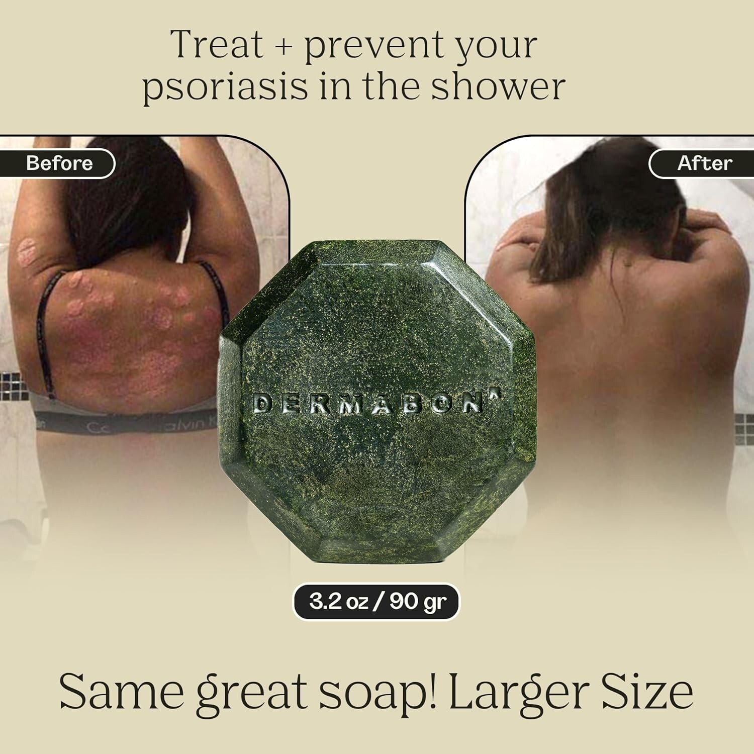 Gentle Coal Tar Soap Bar for Psoriasis Relief – 2% Active Ingredients, 3.2 oz