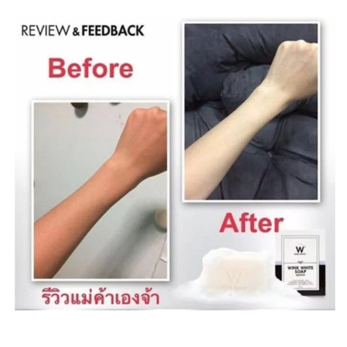 1 X 80g Wink White Soap Gluta Whitening Body Pure Face – Free Shipping