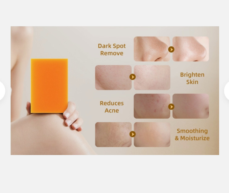 Jabon Blanqueador De Piel Cara Natural Aclarante Aclarador Cuerpo Manchas Oscura