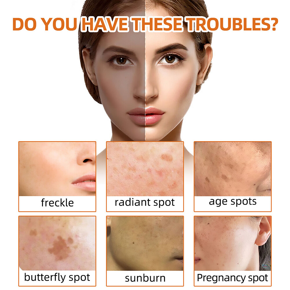 2× Tumeric Soap Skin Whitening Dark Spots lightening Acne Brightening Turmeric