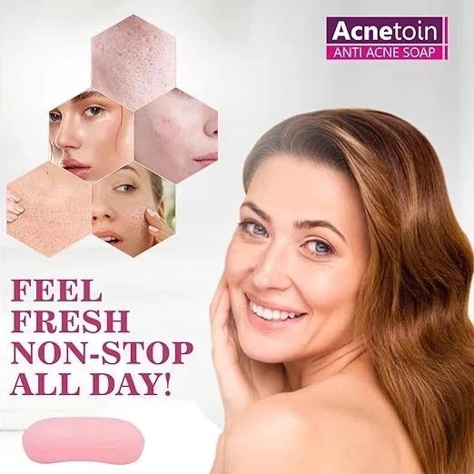 Leeford Women’s Acnetoin Anti Acne Bathing Soap Bar For Oily Skin Pack 4 x 75 gm
