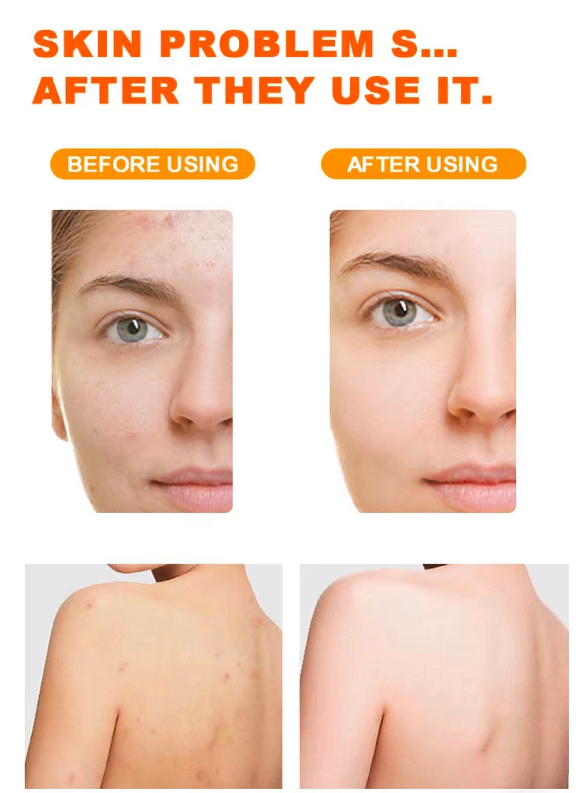 3x Handmade Lemon Soaps Skin Whitening Dark Spots Acne Brightening-Glossy 200G