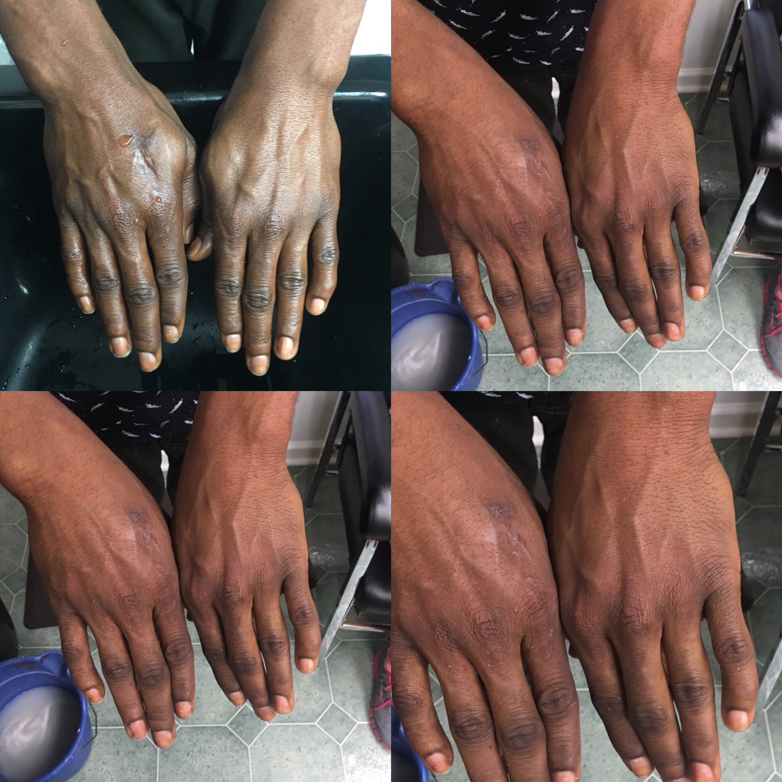 First Step Black Soap Body Wash for Eczema and Sensitive Dry & Oily Skin