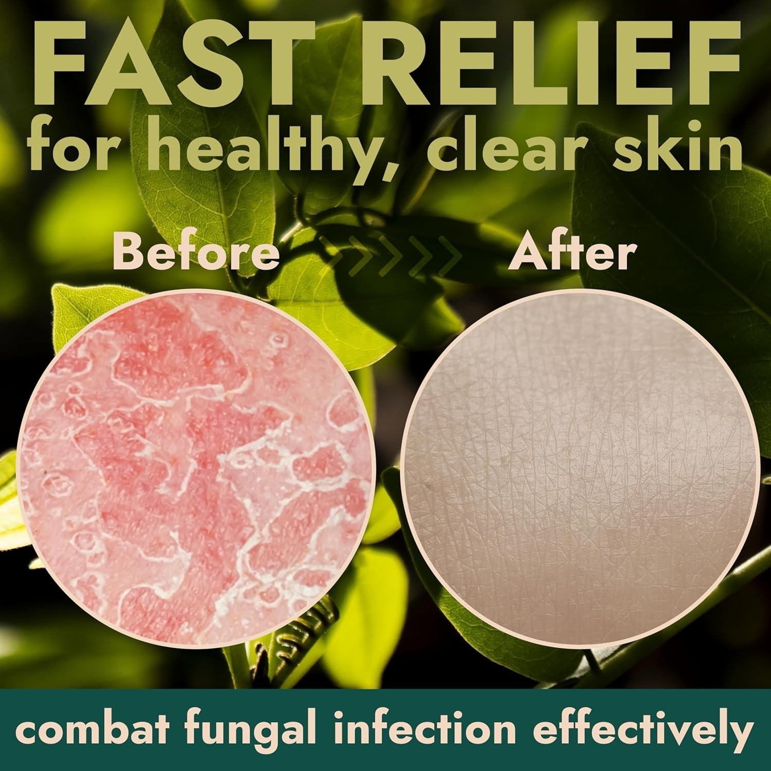 Armor Medicated Antifungal Soap 2 Pack w/ Case | 1% Tolnaftate for Jock Itch …