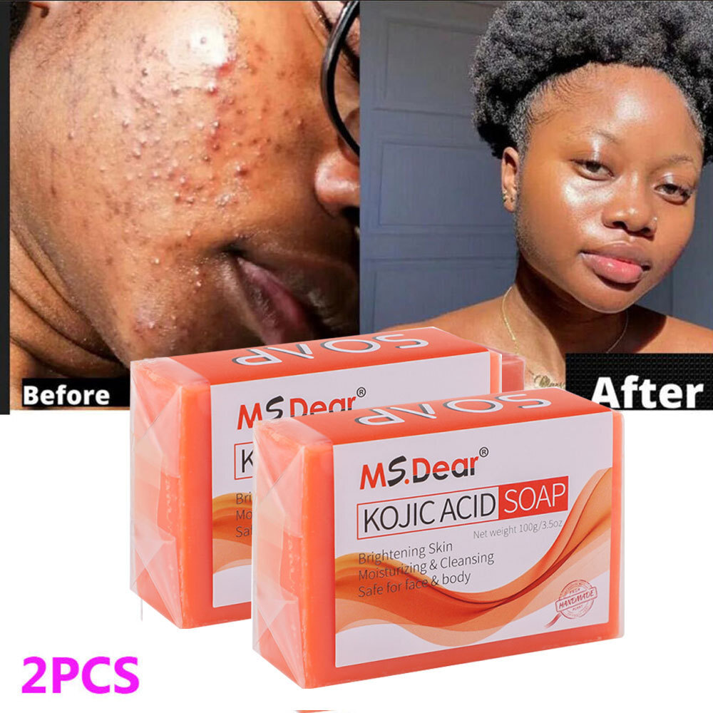 3/5x Kojic Acid Soap Bars Dark Spot Remover Turmeric Brightening Face Body Skin