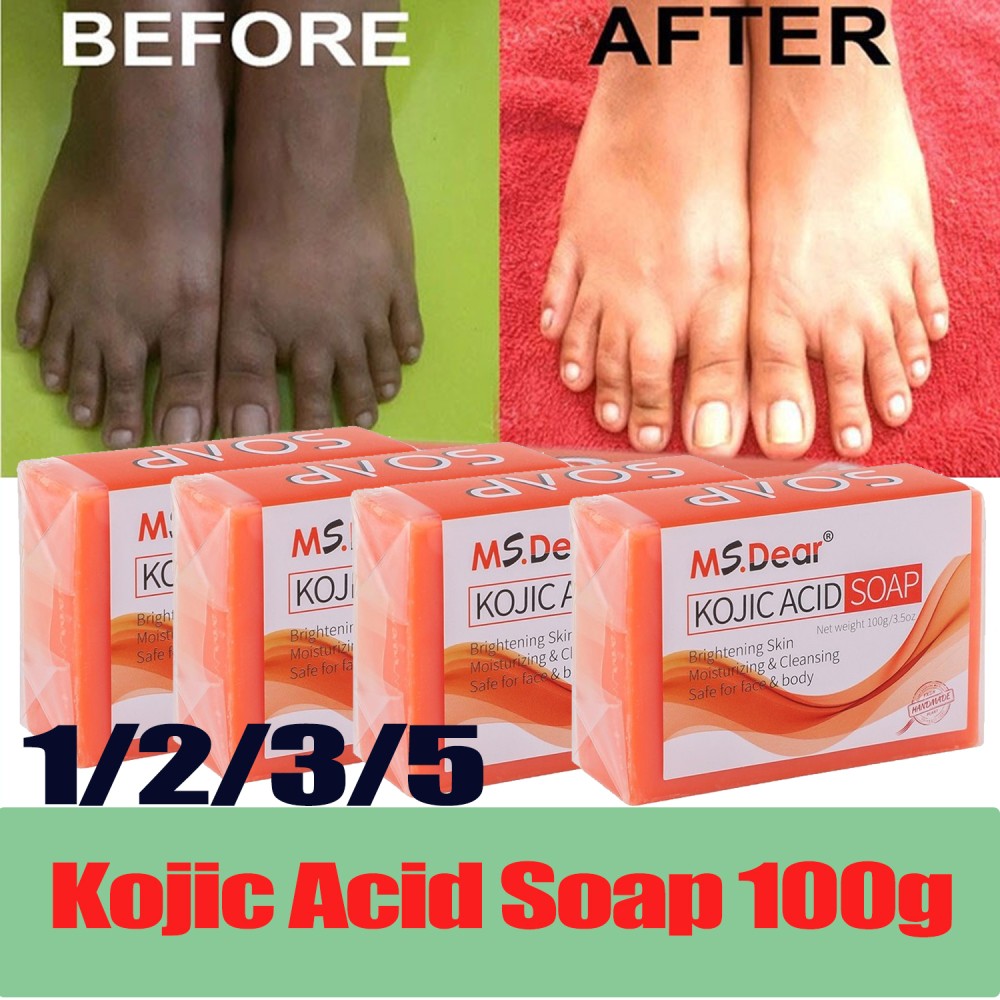 5/1X Kojic Acid Soap Dark Spot Whitening Turmeric Skin Bleaching Lightening 100G
