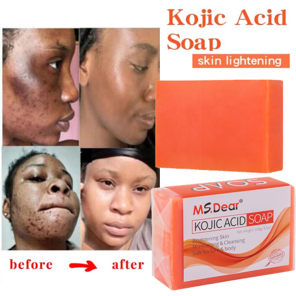 Kojic Acid Dark Spot Remover Soap Bars with Vitamin C Retinol, Collagen Turmeric