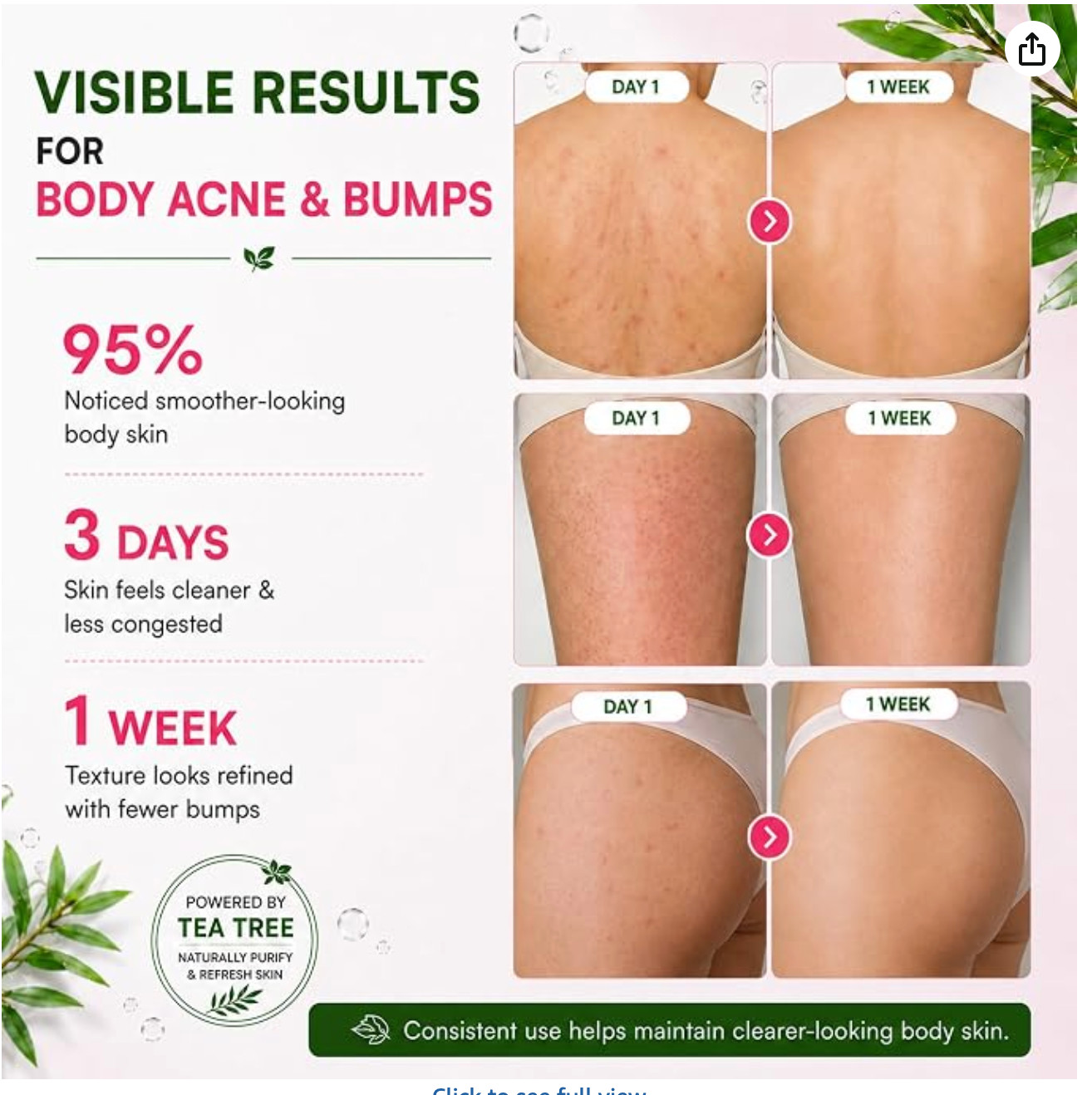 Body Acne Soap Bar Antibacterial Bar for Butt, Thighs, Back, Body Acne, NIB